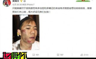 黃博文笑對(duì)賽季報(bào)銷 隊(duì)友：加油兄弟趕上世俱杯